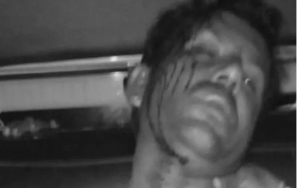 जमीन विवाद में छोटे भाई ने बड़े भाई पर कुल्हाड़ी से किया हमला
